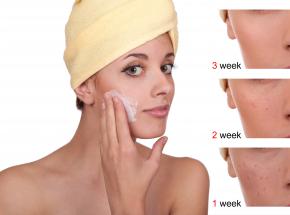 Come curare la dermatite atopica