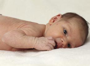 La dermatite atopica nei neonati