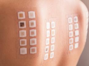 Patch test