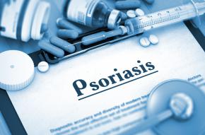 Cura della psoriasi Cura della psoriasi