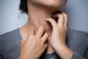Dermatite collo Dermatite collo