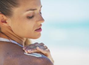 Dermatite da sole 