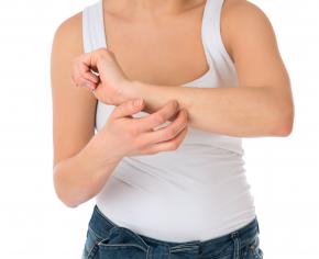 Eczema discoide