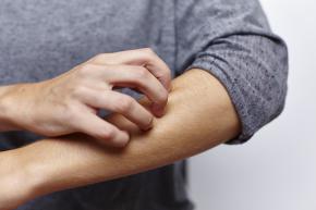 Psoriasi eruttiva