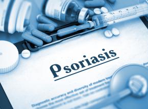 Cura della psoriasi