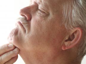 Dermatite da retinoidi