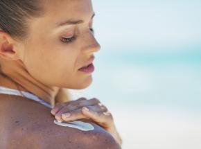 Dermatite da sole 