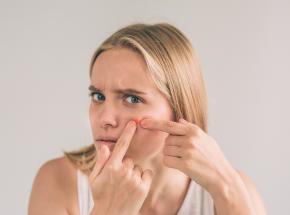 Ectima contagioso