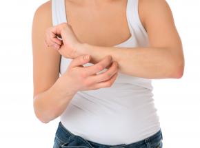Eczema discoide