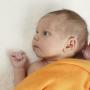 Dermatite neonato