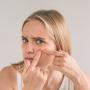 Ectima contagioso