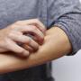 Psoriasi eruttiva